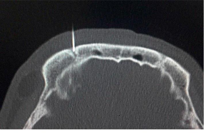 https://cdn.ncbi.nlm.nih.gov/pmc/blobs/91f0/7061117/a64907941141/PRM2020-8142489.001.jpg