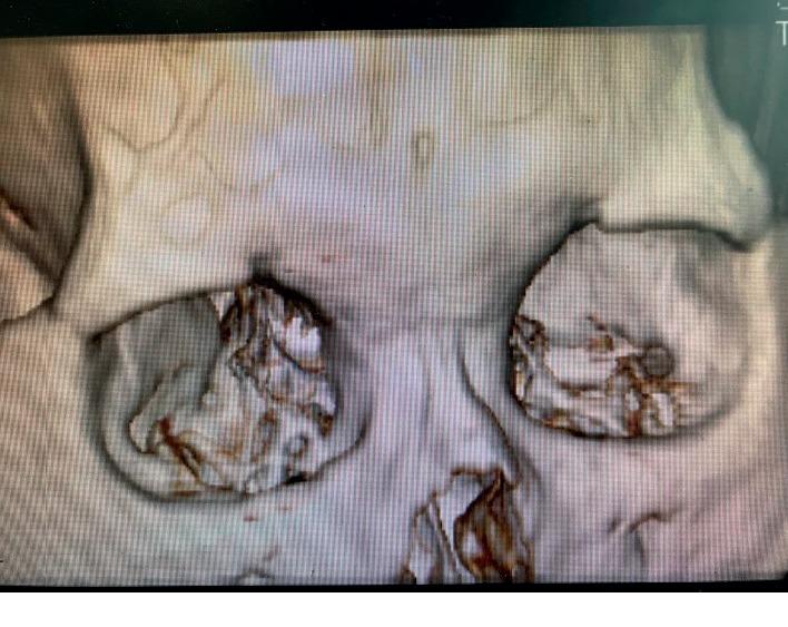 https://cdn.ncbi.nlm.nih.gov/pmc/blobs/91f0/7061117/d685659330f4/PRM2020-8142489.003.jpg