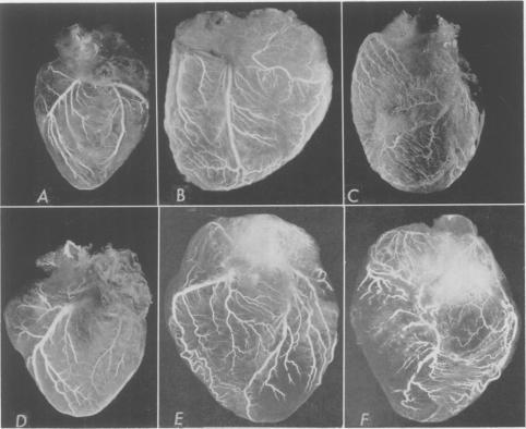 https://cdn.ncbi.nlm.nih.gov/pmc/blobs/91f1/1465566/1f2d90f62bb4/annsurg01265-0019-a.jpg