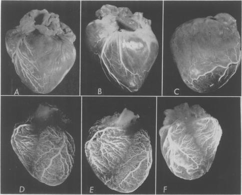 https://cdn.ncbi.nlm.nih.gov/pmc/blobs/91f1/1465566/e7a69ba858ad/annsurg01265-0018-a.jpg