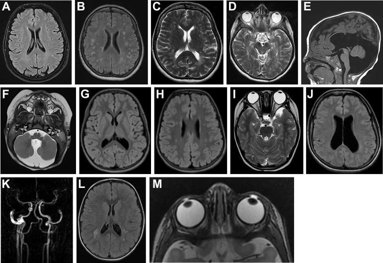 https://cdn.ncbi.nlm.nih.gov/pmc/blobs/91f2/10086512/90c0e74a1c4f/jmg-2022-108646f03.jpg