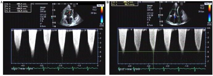 https://cdn.ncbi.nlm.nih.gov/pmc/blobs/91f7/5639404/0f85a7be4e7a/etm-14-04-3616-g04.jpg