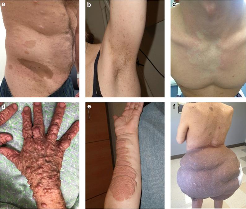 https://cdn.ncbi.nlm.nih.gov/pmc/blobs/91f8/8659402/779aeead82e3/gr1.jpg