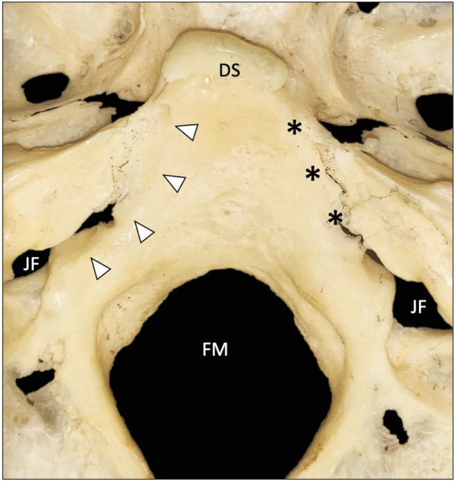 https://cdn.ncbi.nlm.nih.gov/pmc/blobs/91ff/9256480/2c0d80b6bf2f/acb-55-2-135-f5.jpg