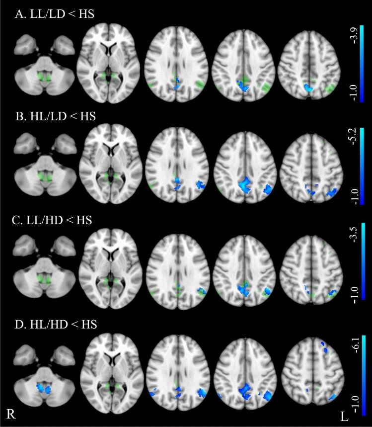 https://cdn.ncbi.nlm.nih.gov/pmc/blobs/9200/11982092/69c5dcb603b0/415_2025_12977_Fig3_HTML.jpg
