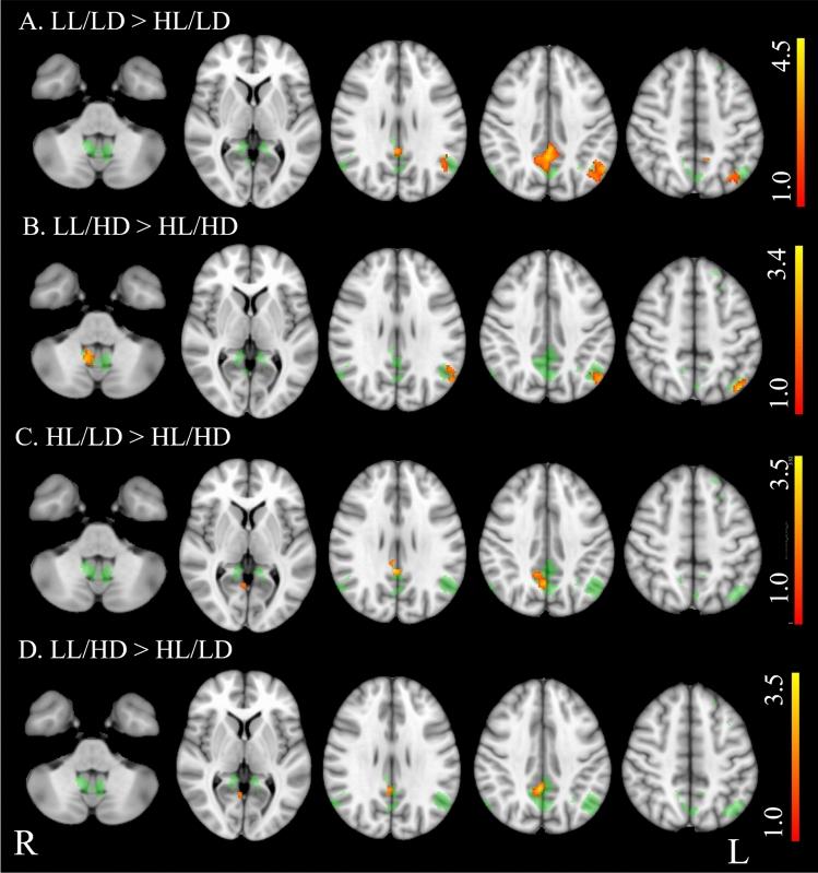 https://cdn.ncbi.nlm.nih.gov/pmc/blobs/9200/11982092/81caa140b9c0/415_2025_12977_Fig5_HTML.jpg