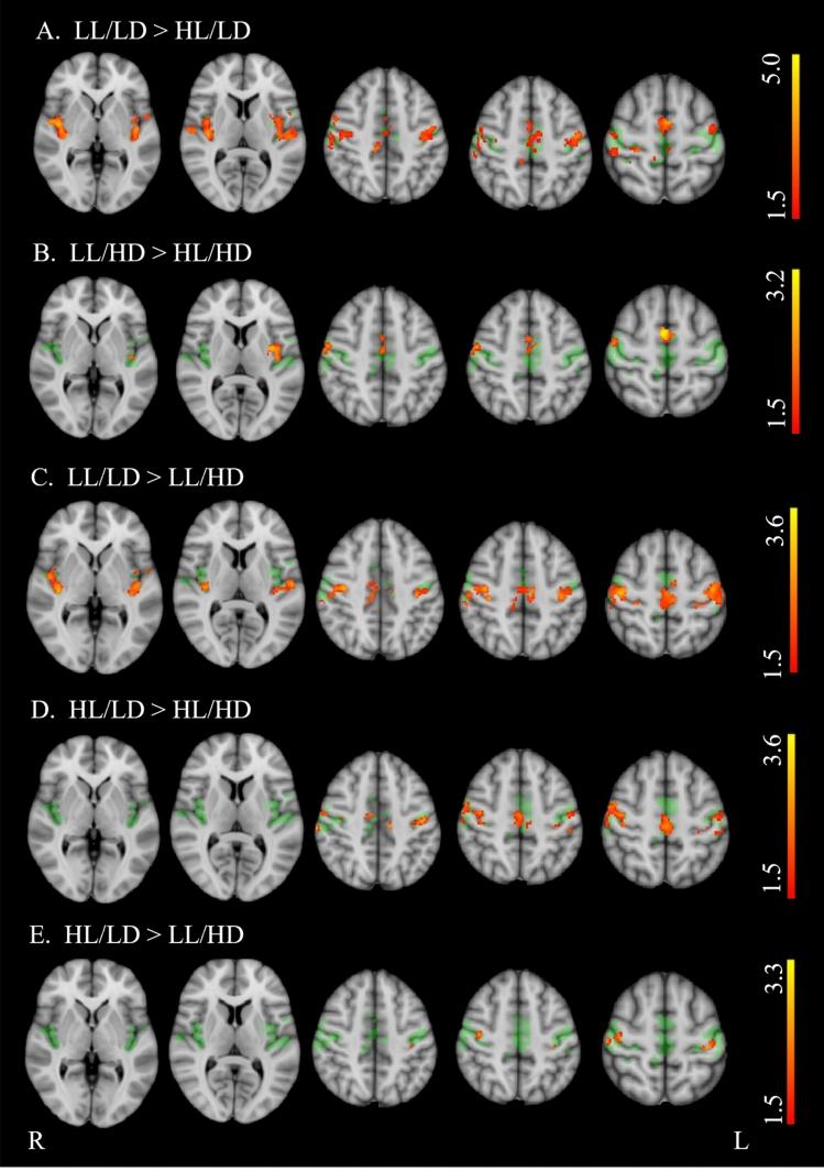 https://cdn.ncbi.nlm.nih.gov/pmc/blobs/9200/11982092/a4886e82b79f/415_2025_12977_Fig4_HTML.jpg