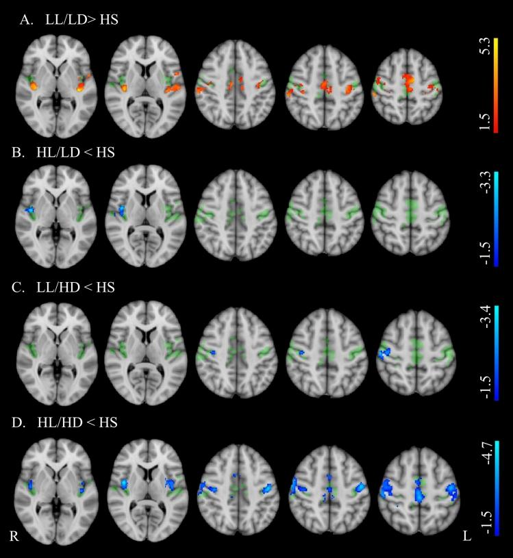 https://cdn.ncbi.nlm.nih.gov/pmc/blobs/9200/11982092/fb4e4b4a01b9/415_2025_12977_Fig2_HTML.jpg