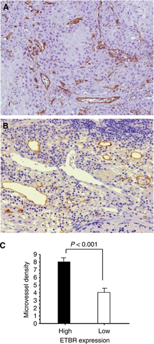https://cdn.ncbi.nlm.nih.gov/pmc/blobs/9203/3929870/40e9f96440e5/bjc2013784f4.jpg