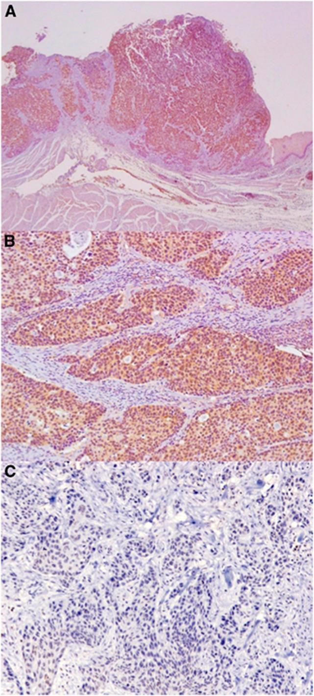 https://cdn.ncbi.nlm.nih.gov/pmc/blobs/9203/3929870/94a2ba534f63/bjc2013784f1.jpg