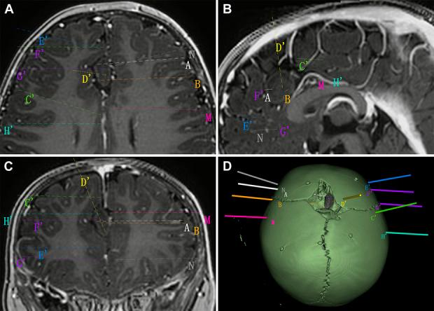 https://cdn.ncbi.nlm.nih.gov/pmc/blobs/9208/11155594/eeb48e1eb461/neu-95-137-g002.jpg