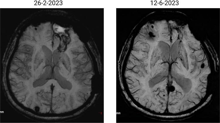 https://cdn.ncbi.nlm.nih.gov/pmc/blobs/920a/11806917/6b6d59a0aada/rjaf033f5.jpg