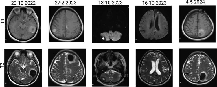 https://cdn.ncbi.nlm.nih.gov/pmc/blobs/920a/11806917/ad1a2c38195e/rjaf033f4.jpg