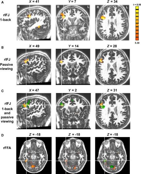 https://cdn.ncbi.nlm.nih.gov/pmc/blobs/920e/3108382/122d65726d77/fnhum-05-00051-g001.jpg