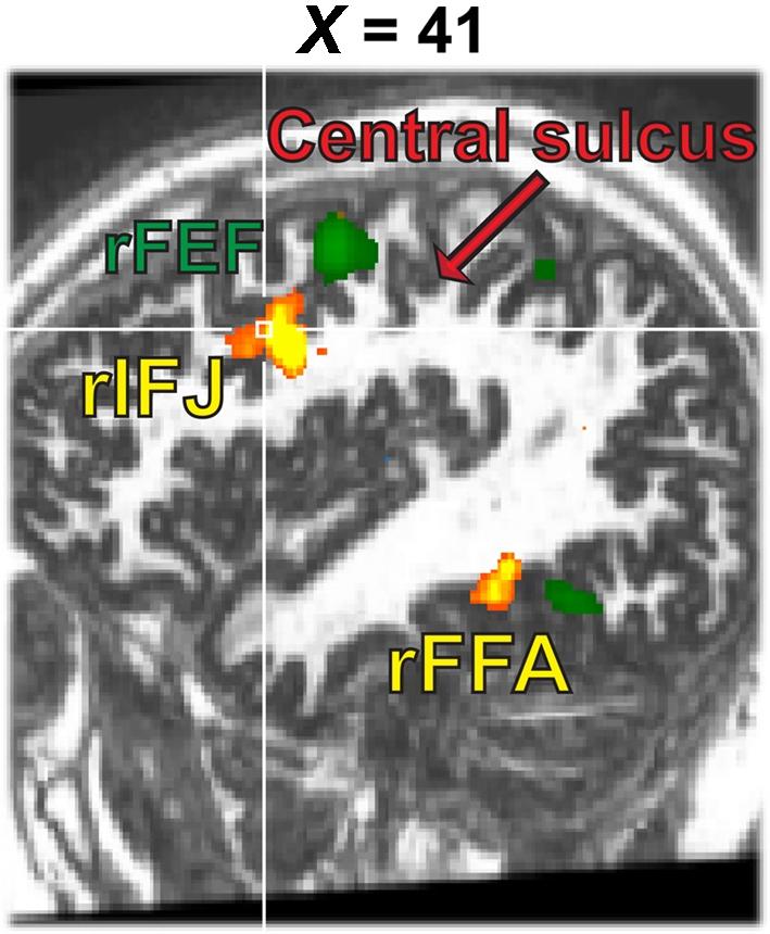https://cdn.ncbi.nlm.nih.gov/pmc/blobs/920e/3108382/1fc4703ddfca/fnhum-05-00051-g004.jpg