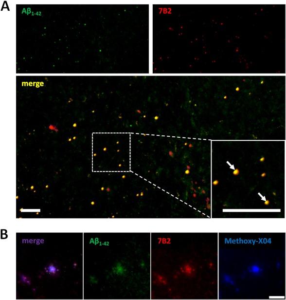 https://cdn.ncbi.nlm.nih.gov/pmc/blobs/9211/3542996/5420395733f2/zbc0061336420001.jpg