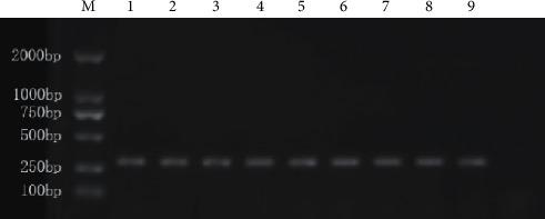 https://cdn.ncbi.nlm.nih.gov/pmc/blobs/9217/8941553/7b9956eb5161/ECAM2022-3086205.003.jpg