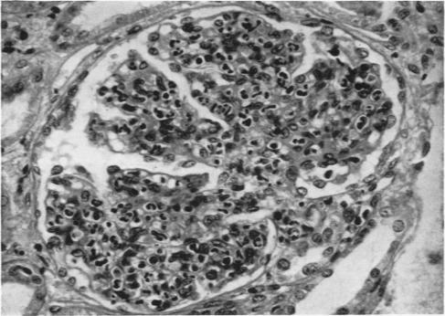 https://cdn.ncbi.nlm.nih.gov/pmc/blobs/921b/2019316/c30de731d77c/archdisch01583-0007-a.jpg