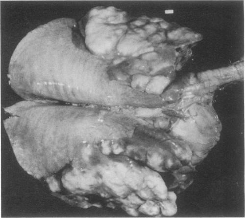 https://cdn.ncbi.nlm.nih.gov/pmc/blobs/921f/358176/0e020ca4d1f7/cmr00042-0038-a.jpg