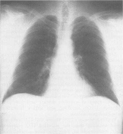 https://cdn.ncbi.nlm.nih.gov/pmc/blobs/9225/1012171/175229b9f395/brjindmed00008-0023-a.jpg