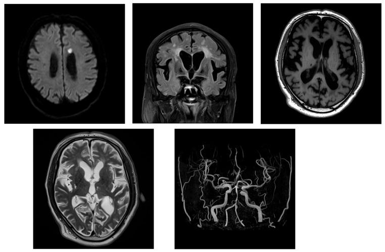 https://cdn.ncbi.nlm.nih.gov/pmc/blobs/922d/12196192/880a32bd0914/neurolint-17-00086-g004.jpg