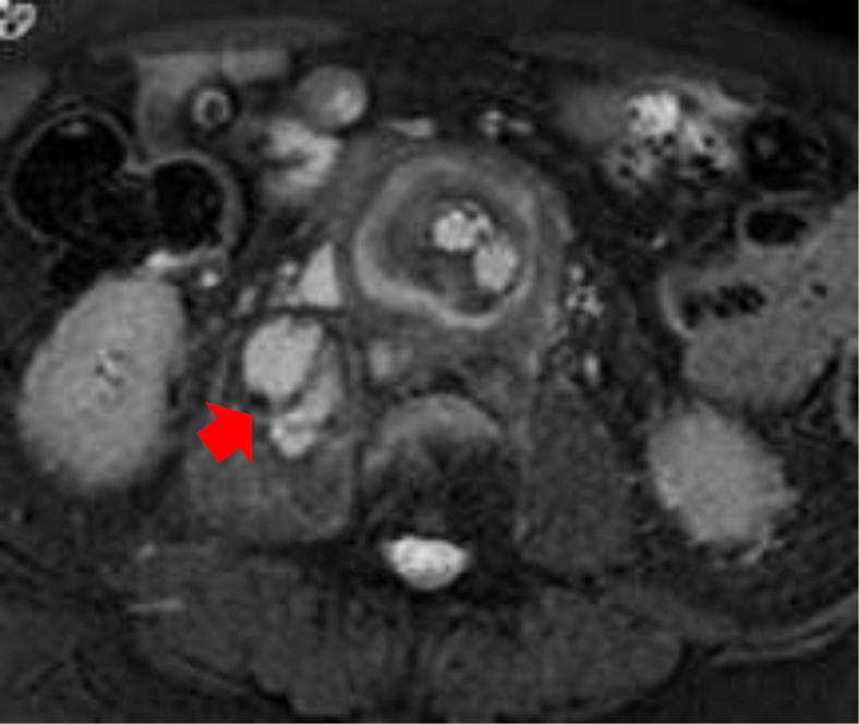 https://cdn.ncbi.nlm.nih.gov/pmc/blobs/922f/6529692/2da0c65bb9d7/gr1.jpg