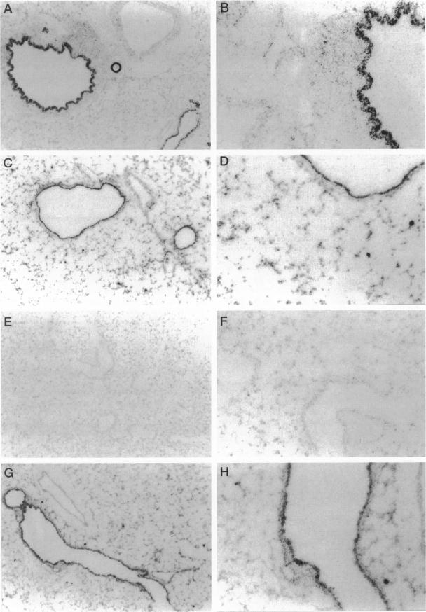 https://cdn.ncbi.nlm.nih.gov/pmc/blobs/9233/1858137/6683c2c37378/amjpathol00013-0266-a.jpg
