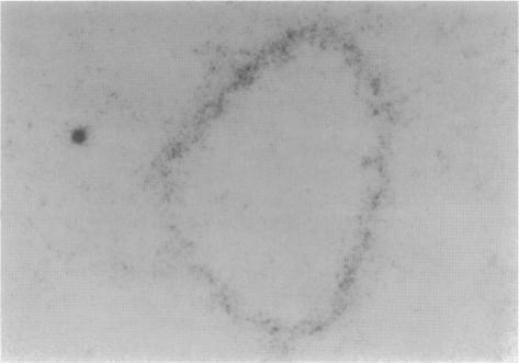 https://cdn.ncbi.nlm.nih.gov/pmc/blobs/9233/1858137/e91610d41303/amjpathol00013-0265-b.jpg