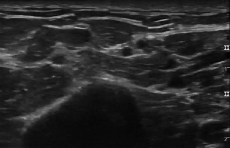 https://cdn.ncbi.nlm.nih.gov/pmc/blobs/9240/9634466/43f48893d9a6/acr-06-22-33-vid1.jpg