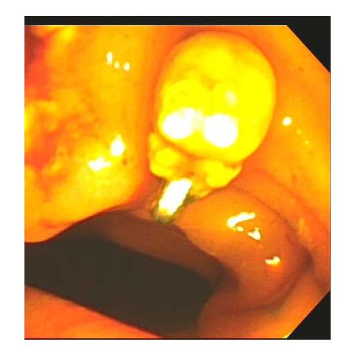 https://cdn.ncbi.nlm.nih.gov/pmc/blobs/9245/6444230/b5e40ff220bd/CRIGM2019-8038469.004.jpg