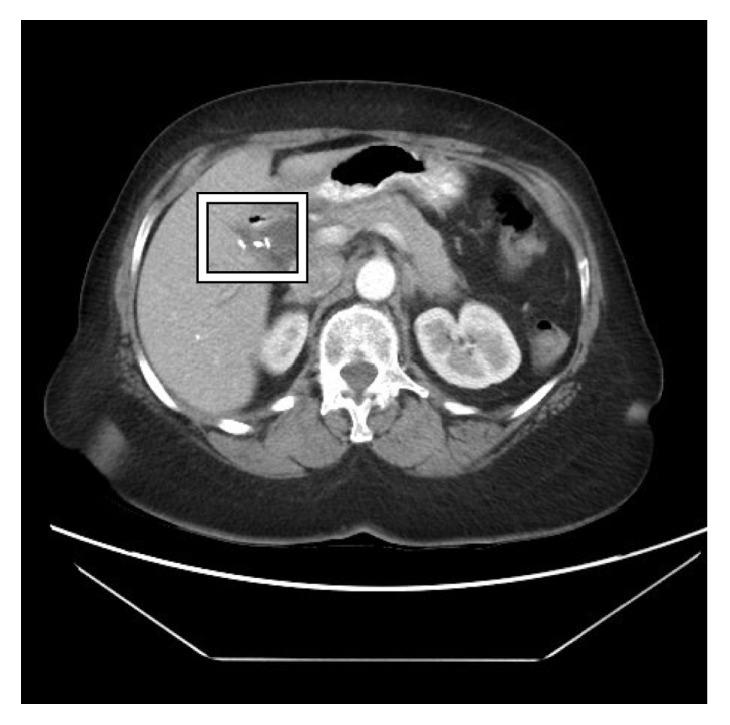 https://cdn.ncbi.nlm.nih.gov/pmc/blobs/9245/6444230/b8f08ff7f630/CRIGM2019-8038469.001.jpg