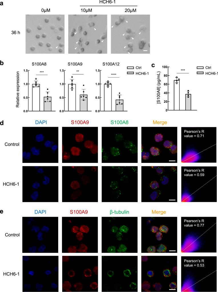 https://cdn.ncbi.nlm.nih.gov/pmc/blobs/9248/11473795/42685168706f/42003_2024_7025_Fig6_HTML.jpg