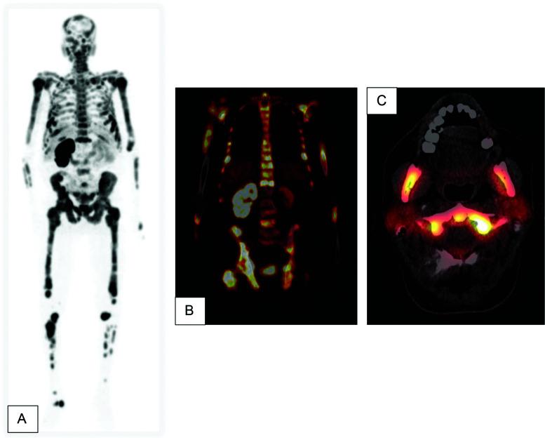 https://cdn.ncbi.nlm.nih.gov/pmc/blobs/9252/10753930/108893883cc7/acc-10-04-10267-g001.jpg