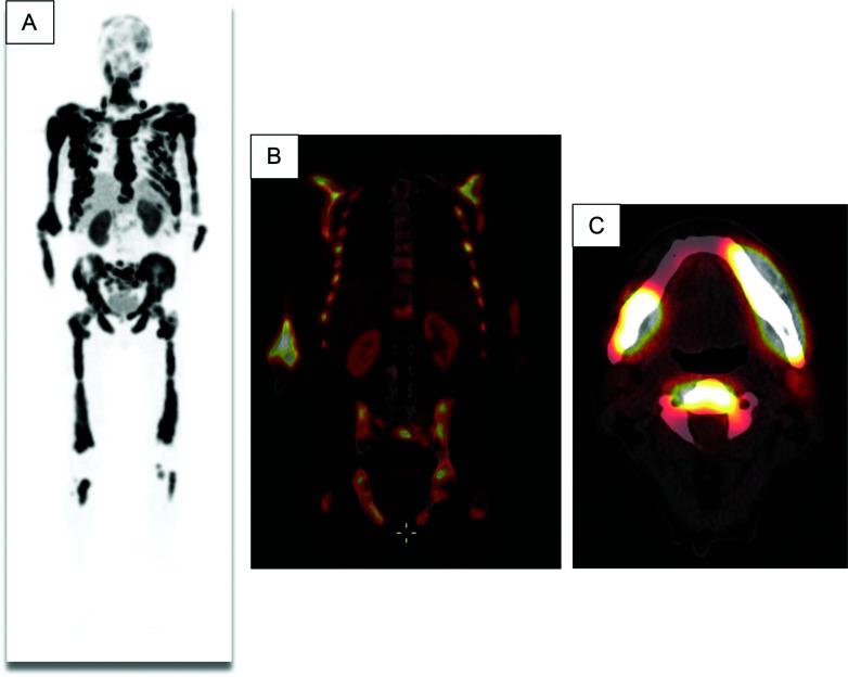 https://cdn.ncbi.nlm.nih.gov/pmc/blobs/9252/10753930/142b5136a13a/acc-10-04-10267-g006.jpg