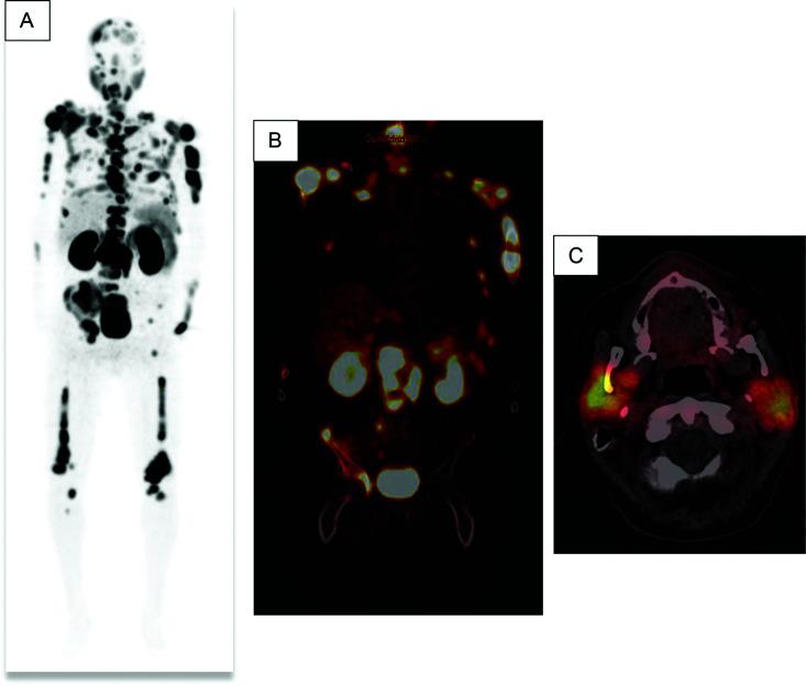 https://cdn.ncbi.nlm.nih.gov/pmc/blobs/9252/10753930/d1e814c68384/acc-10-04-10267-g004.jpg