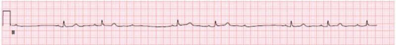 https://cdn.ncbi.nlm.nih.gov/pmc/blobs/9256/6367108/f153d9663548/cureus-0010-00000003674-i04.jpg
