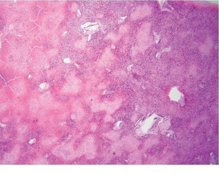https://cdn.ncbi.nlm.nih.gov/pmc/blobs/9257/7049424/62f776dff88f/CRIHEP2020-2135239.001.jpg