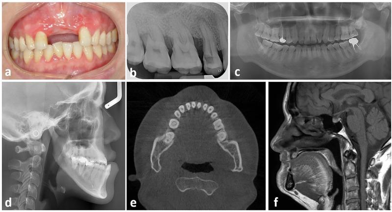 https://cdn.ncbi.nlm.nih.gov/pmc/blobs/925b/12228768/2c6ceeb5a86f/41746_2025_1818_Fig3_HTML.jpg