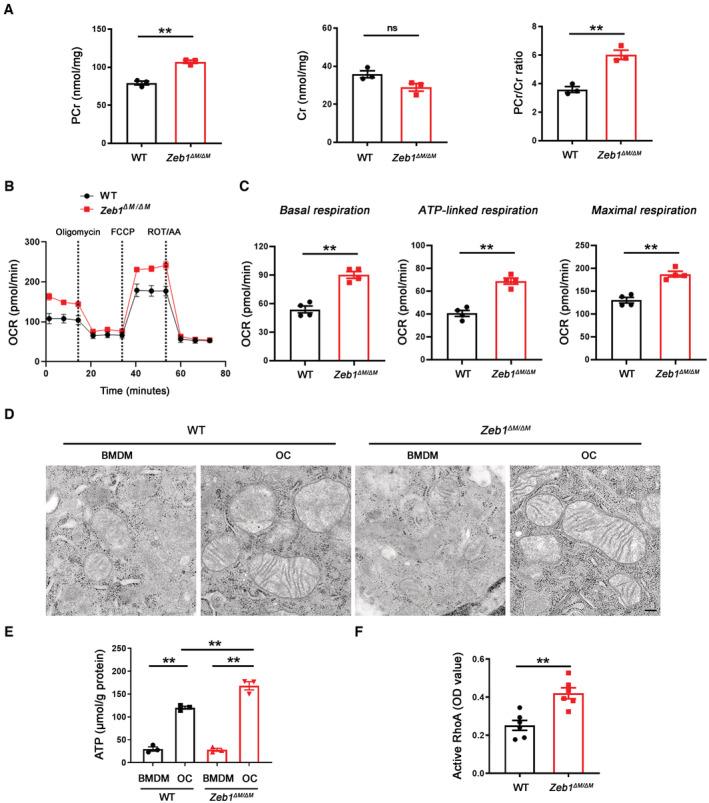 https://cdn.ncbi.nlm.nih.gov/pmc/blobs/925c/10068323/1914b408e1f5/EMBJ-42-e111148-g001.jpg