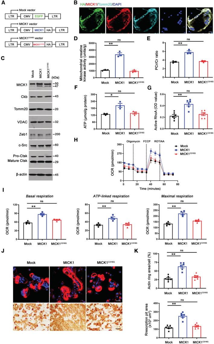 https://cdn.ncbi.nlm.nih.gov/pmc/blobs/925c/10068323/2308c8789930/EMBJ-42-e111148-g011.jpg