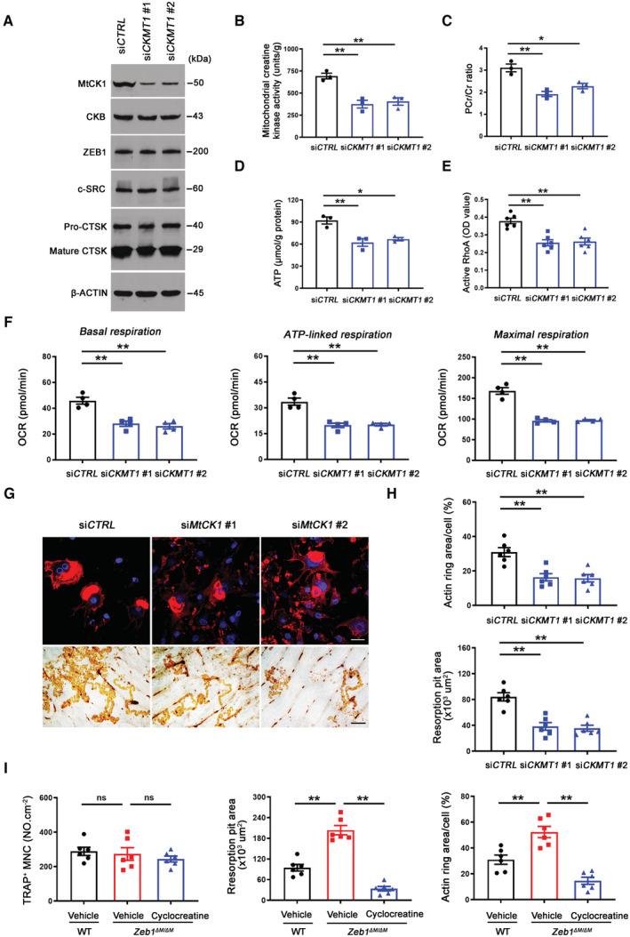 https://cdn.ncbi.nlm.nih.gov/pmc/blobs/925c/10068323/2a724d0682da/EMBJ-42-e111148-g014.jpg