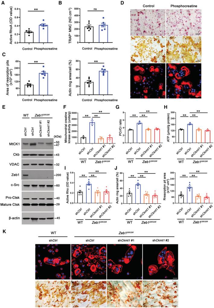 https://cdn.ncbi.nlm.nih.gov/pmc/blobs/925c/10068323/65d38b95b6db/EMBJ-42-e111148-g010.jpg