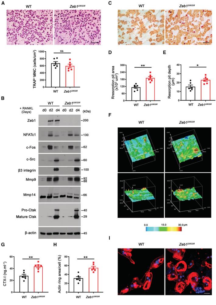 https://cdn.ncbi.nlm.nih.gov/pmc/blobs/925c/10068323/71bc71328d9c/EMBJ-42-e111148-g013.jpg