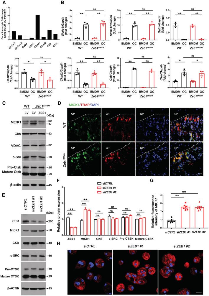 https://cdn.ncbi.nlm.nih.gov/pmc/blobs/925c/10068323/8f7d32944025/EMBJ-42-e111148-g007.jpg