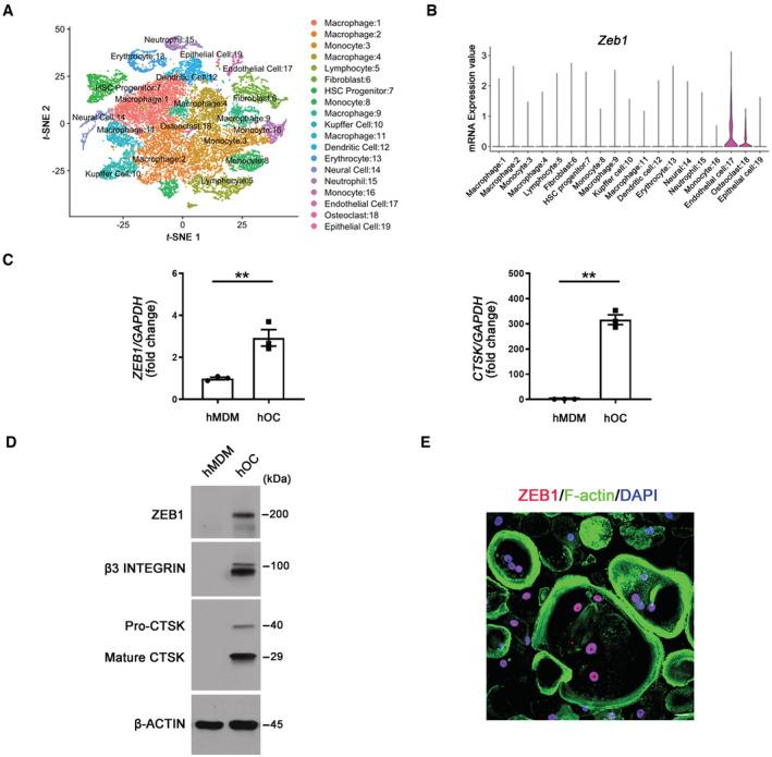 https://cdn.ncbi.nlm.nih.gov/pmc/blobs/925c/10068323/c0591b799400/EMBJ-42-e111148-g004.jpg