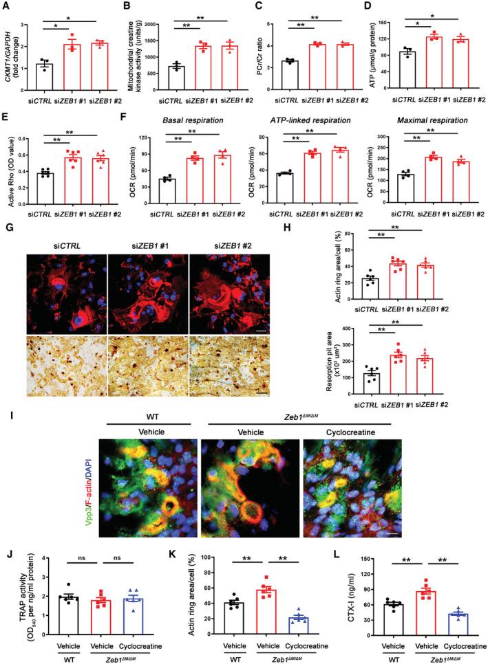 https://cdn.ncbi.nlm.nih.gov/pmc/blobs/925c/10068323/c93f35312b61/EMBJ-42-e111148-g009.jpg