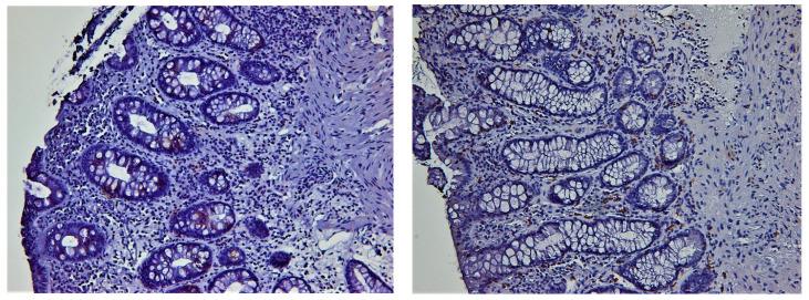 https://cdn.ncbi.nlm.nih.gov/pmc/blobs/9268/10376510/6ace93fa6455/biomedicines-11-01860-g004.jpg