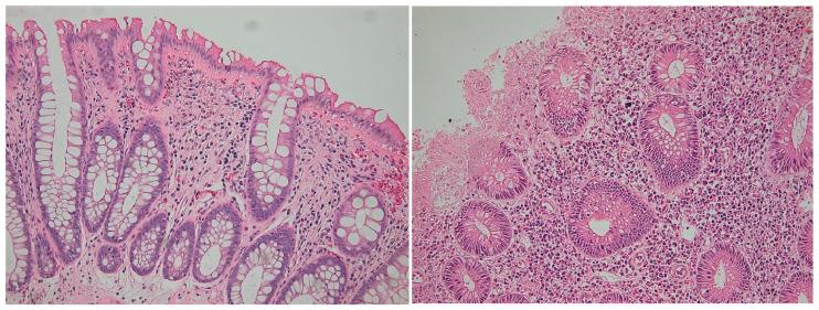 https://cdn.ncbi.nlm.nih.gov/pmc/blobs/9268/10376510/a2c9fc6f7204/biomedicines-11-01860-g003.jpg