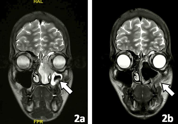 https://cdn.ncbi.nlm.nih.gov/pmc/blobs/9268/12354911/8b3dc9445fe1/cureus-0017-00000087985-i02.jpg