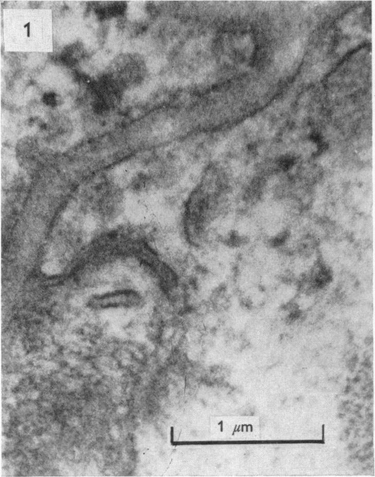 https://cdn.ncbi.nlm.nih.gov/pmc/blobs/9269/1330728/425ffe7ff0f8/jphysiol00916-0089-a.jpg
